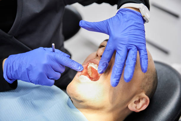 Best Dentist for Tooth Abscess  in Wheat Ridge, CO